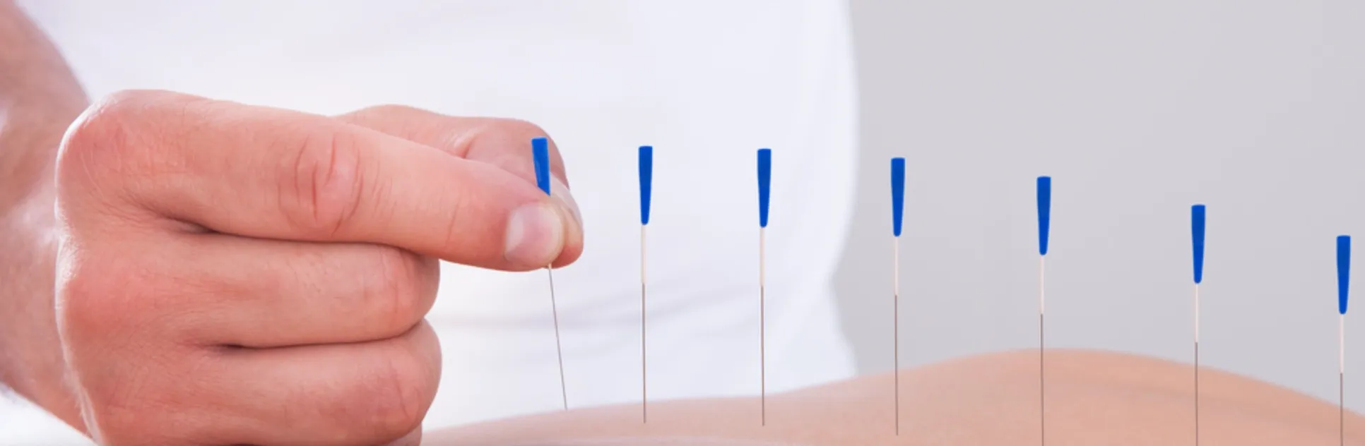 acupuncture à montréal, aiguilles