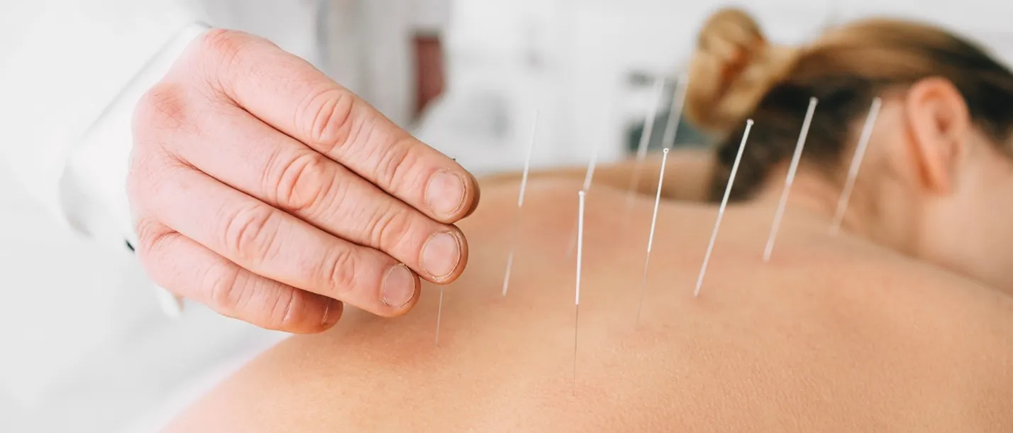 recherche en acupuncture 