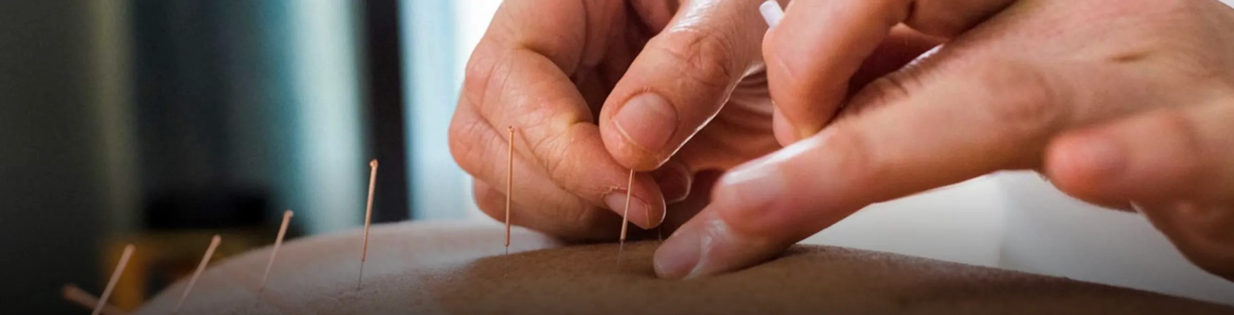 L'Acupuncture dans le Sport : Soulager et Prévenir les Blessures chez les Athlètes